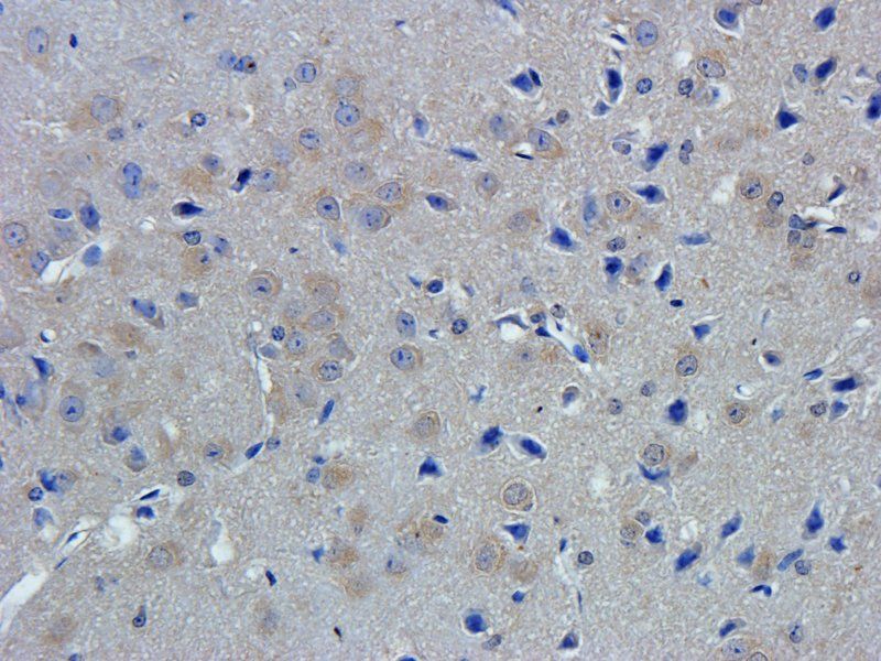 ZNT8 Rabbit Polyclonal Antibody