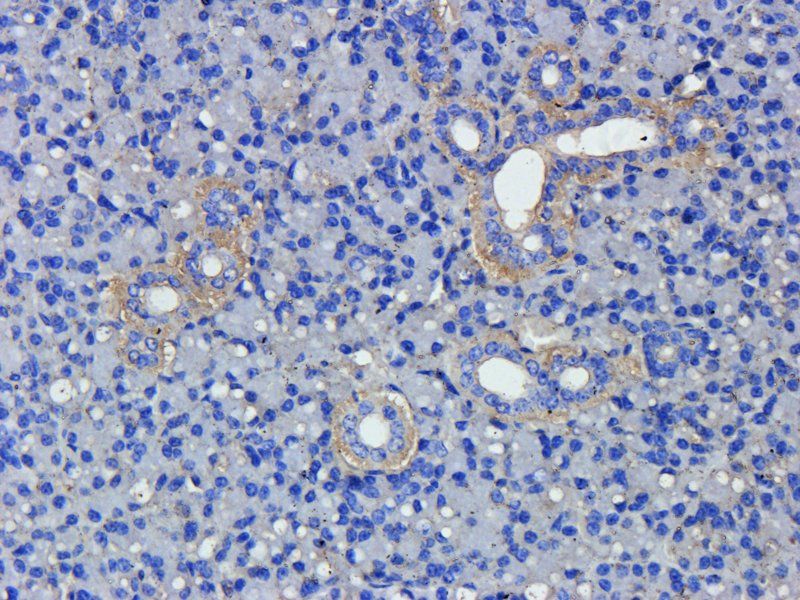 ZNT8 Rabbit Polyclonal Antibody