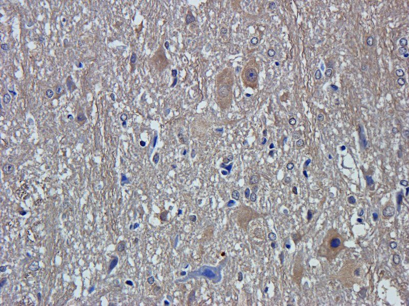 ZNT8 Rabbit Polyclonal Antibody