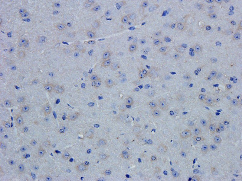 ZNT8 Rabbit Polyclonal Antibody