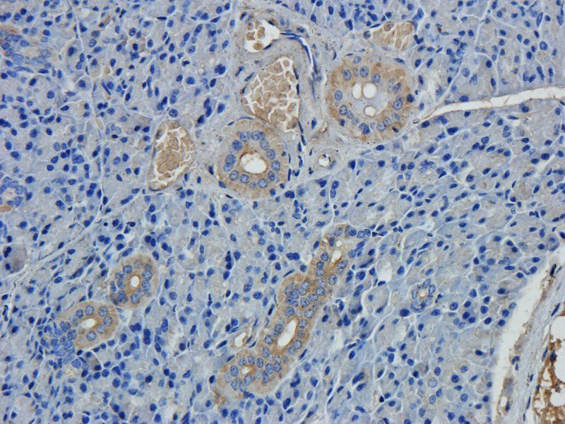 ZNT8 Rabbit Polyclonal Antibody