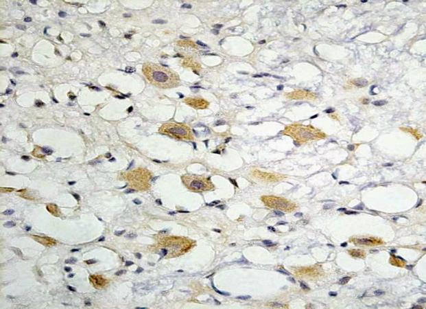 ZO-1 Rabbit Polyclonal Antibody