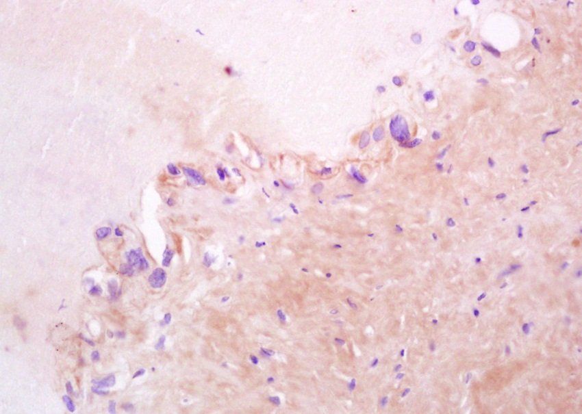 ZO-1 Rabbit Polyclonal Antibody