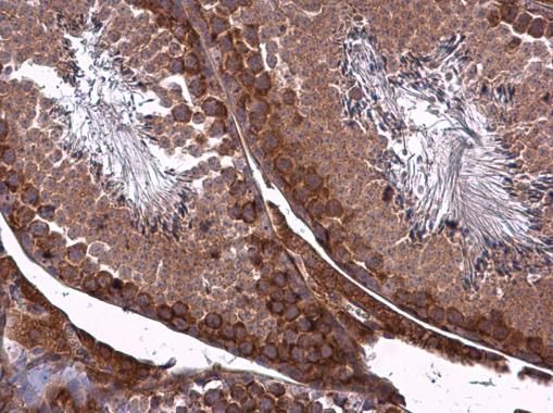 ZO-1 Rabbit Polyclonal Antibody