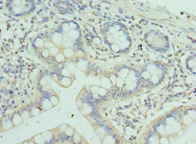ZSCAN9 Antibody