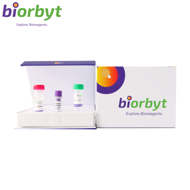 SGSH Rabbit Polyclonal Antibody (HRP)