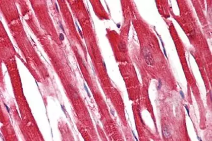 Immunohistochemical staining showing S100A1 antibody