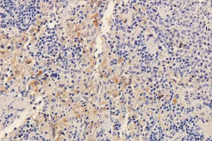 IHC-P staining showing SOX2 antibody localization