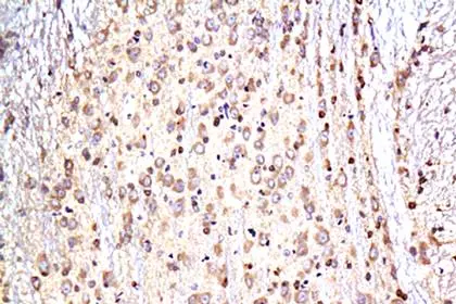 Immunohistochemical analysis showing Tau antibody staining