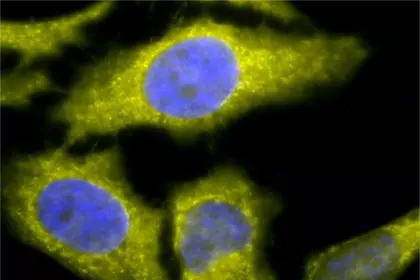 Immunofluorescence analysis of heat shocked HeLa cells using TCP1-alpha antibody
