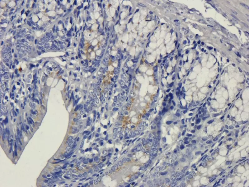 IHC-P staining of VEGFA in rat colon tissue