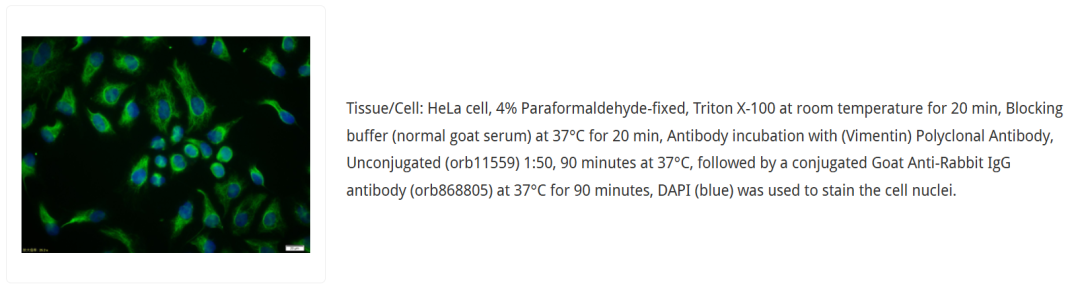 orb11559 免疫荧光：HeLa 细胞